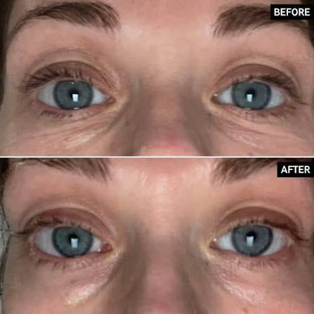 M.ASAM VINOLIFT Anti-Aging Eye Contour Cream with Resveratrol