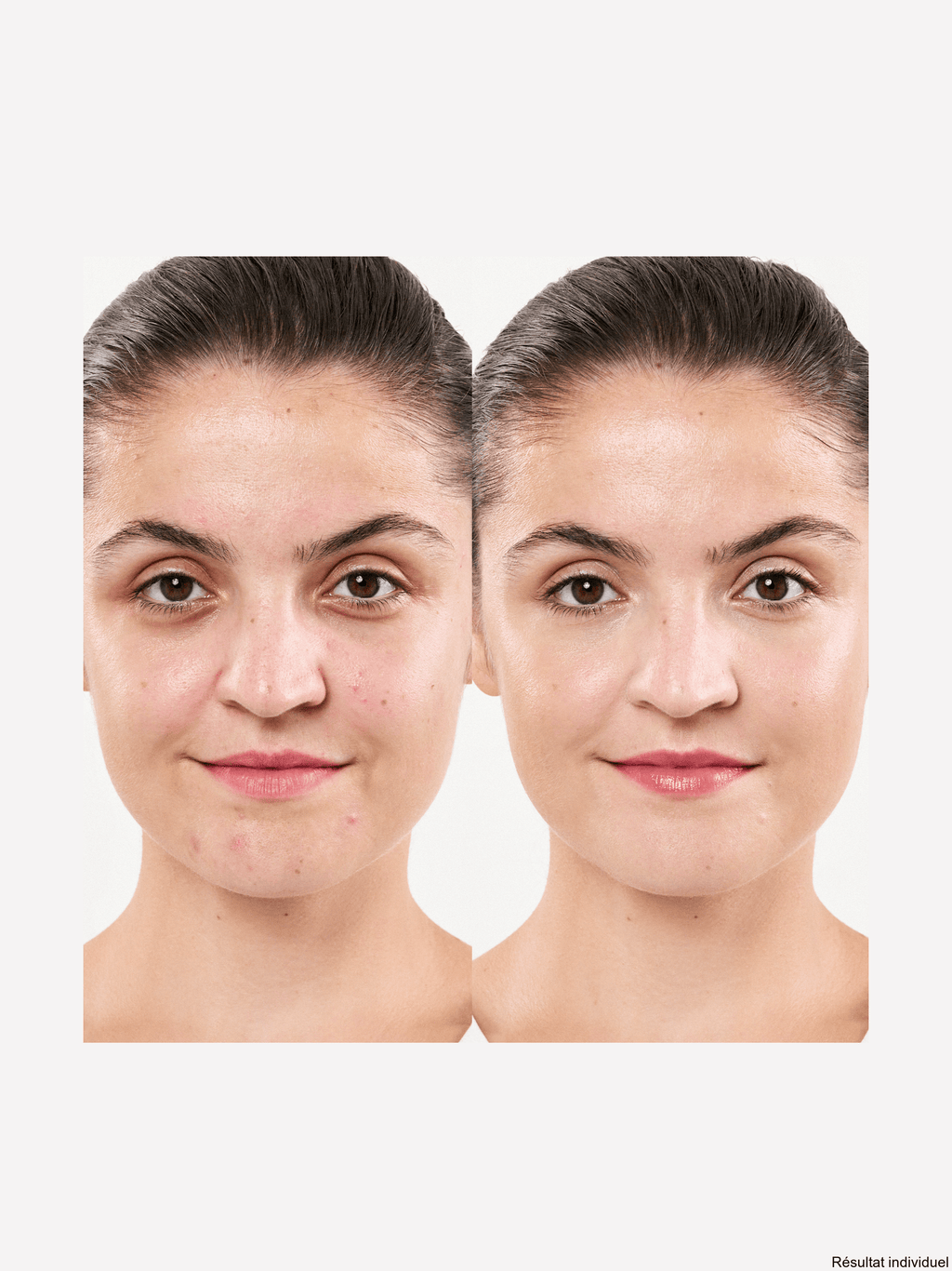 M. ASAM CLEAR SKIN after removing makeup