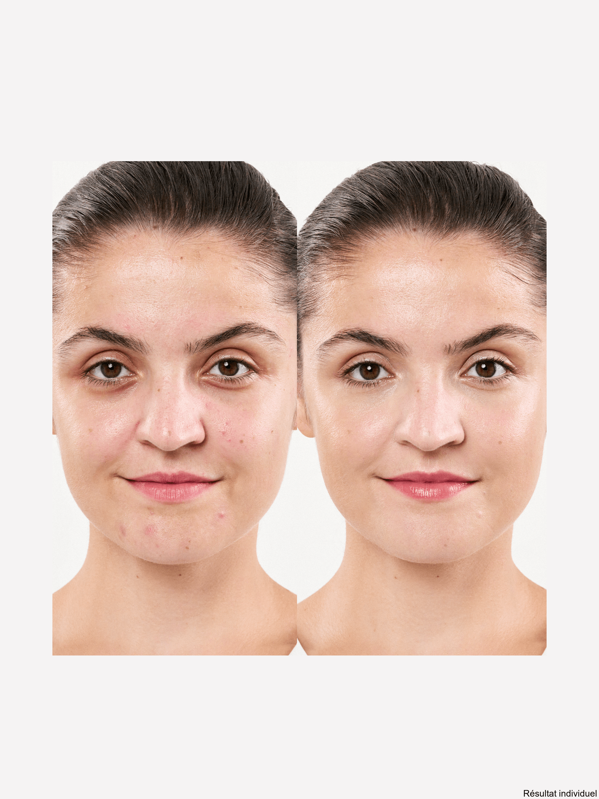 M. ASAM CLEAR SKIN after removing makeup