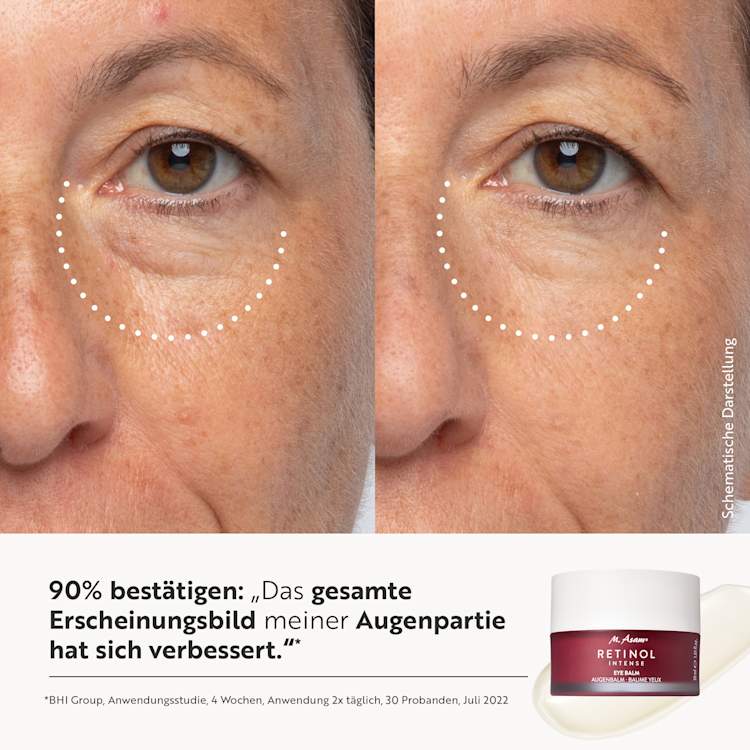 Retinol bundle